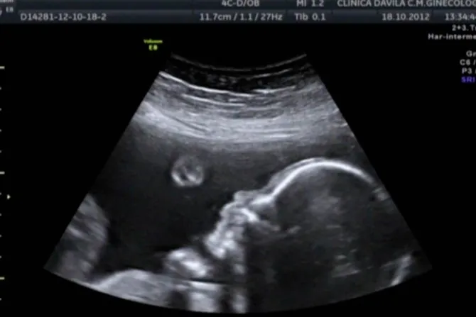 Estudio demuestra que los bebés en el vientre pueden reconocer rostros humanos