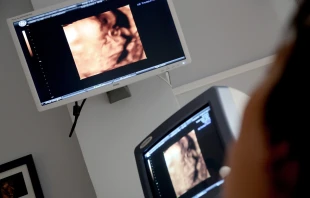 Imagen referencial de una ecografía prenatal. Crédito: Pixabay.