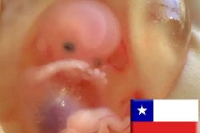 Aprueban debatir despenalización del aborto terapéutico en Chile