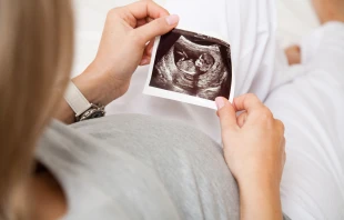 Imagen referencial Crédito: Shutterstock