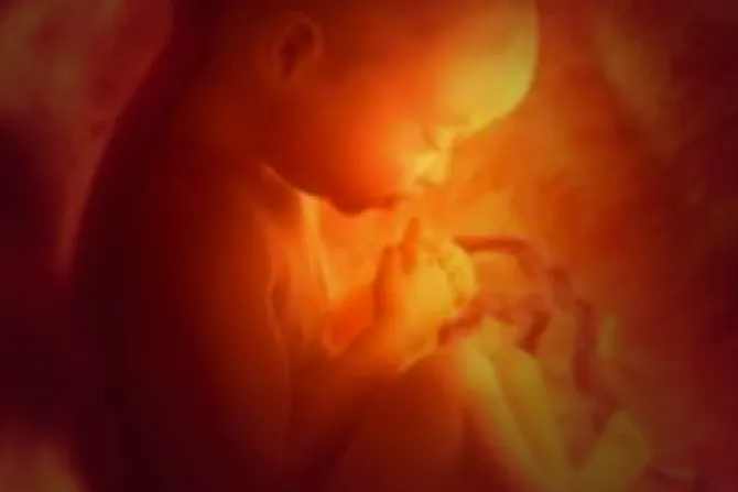 Bebé colombiana sobrevivió a aborto y la llaman "Milagro"