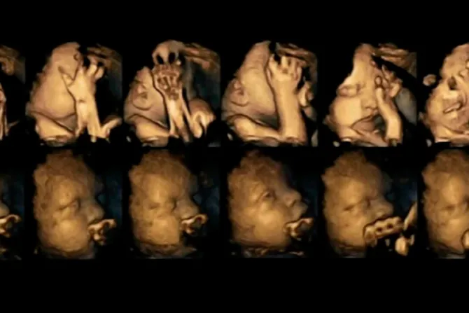 [VIDEO] ¿Fumas y estás embarazada? Así reacciona tu bebé cada vez que lo haces