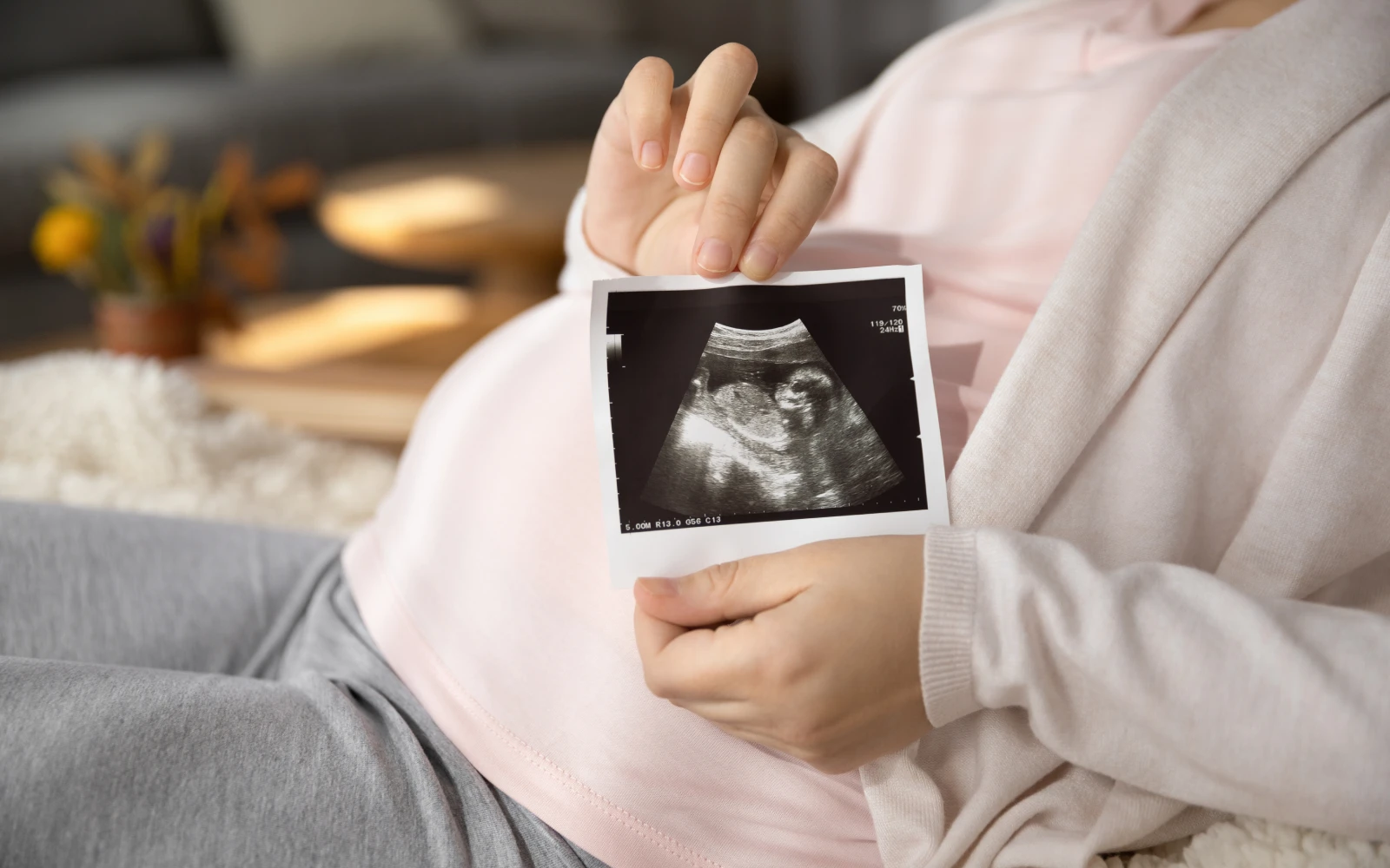 Imagen referencial.?w=200&h=150