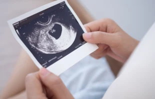 Imagen referencial. Crédito: Shutterstock