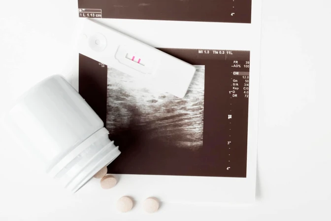 Ecografía y píldoras.