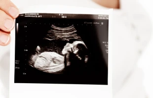 Ecografía de un bebé. Imagen referencial. Crédito: Pixabay.