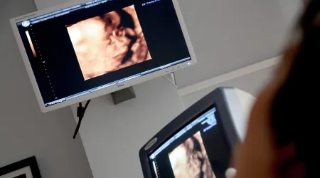 Experto denuncia “discriminación brutal” a médicos objetores de conciencia al aborto