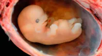 Embrión / Foto: Steven O'Connor, M.D., Houston Texas