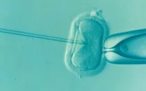 Imagen referencial / Fecundación in vitro.