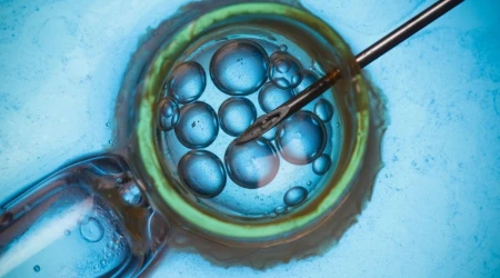 Fecundación in vitro (FIV)