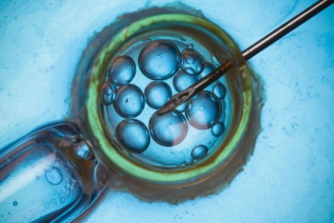Fecundación in vitro (FIV)