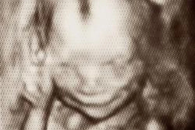 Investigadores afirman que a las 17 semanas feto experimenta sentimientos