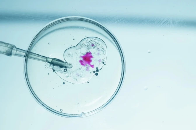 Fecundación in vitro