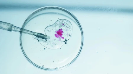 Fecundación in vitro