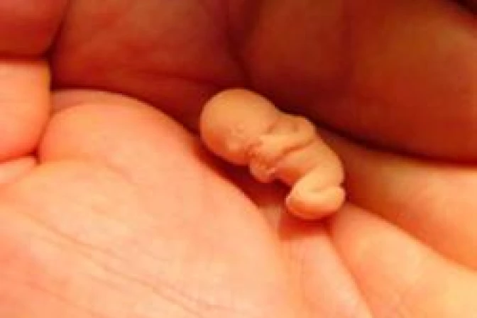 Argumentos religiosos también valen para defender a no nacidos ante aborto