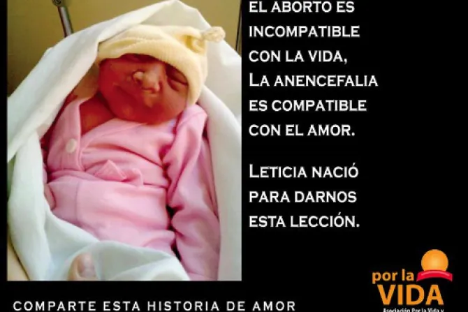 Lanzan campaña para sensibilizar sobre aborto de bebés con anencefalia