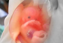 Imagen referencial. Foto: suparna sinha (CC BY-SA 2.0)