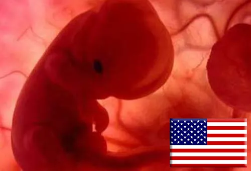 EE.UU.: Dakota del Norte blinda vida contra el aborto