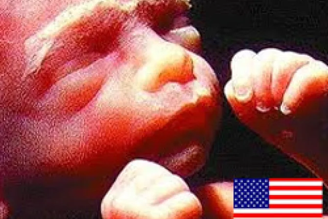 Aborto muy fácil de conseguir, opina casi la mitad de EEUU