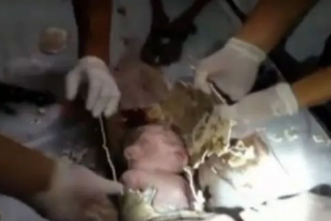 VIDEO: Rescatan a bebé de tubería de desagüe en China