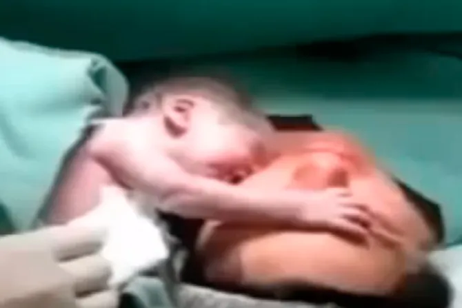 [VIDEO] Bebé recién nacido que se aferra a su madre conmueve a millones