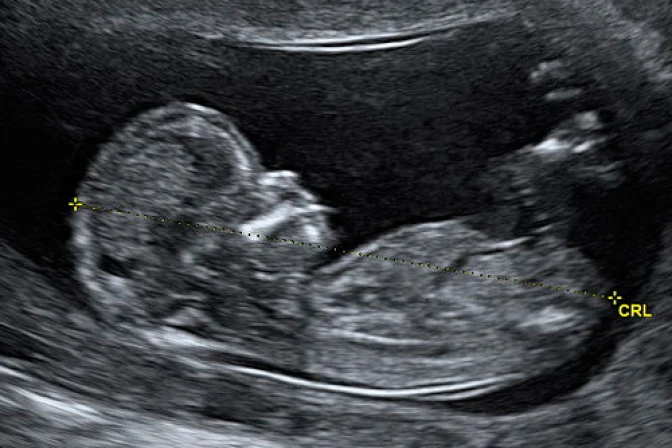 Madre pide le permitan sepultar a su bebé que institución médica considera "residuo biológico"