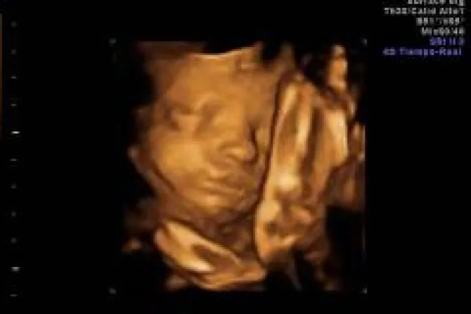 Bebés por nacer bostezan en el útero, revela estudio