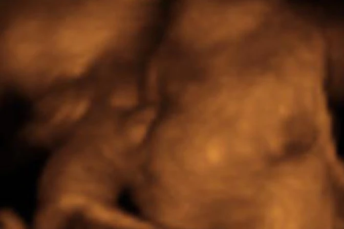 No nacidos se unirán a defensa de la vida con ecografías 3D y 4D