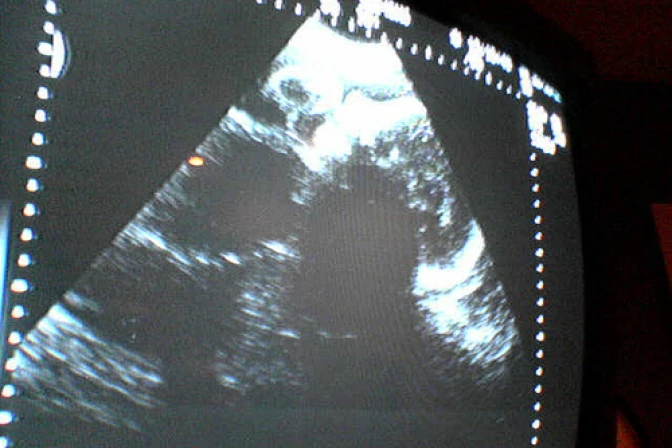 Darán certificado de defunción a madre de bebé considerada "residuo biológico"