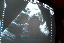 Imagen referencial. Foto: Matt Haughey (CC BY-NC-SA 2.0)