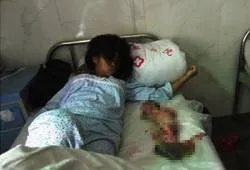 Feng Jianmei y su bebé abortado