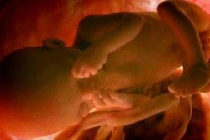 Debate científico ante el aborto: ¿A partir de cuándo un no nacido siente dolor?