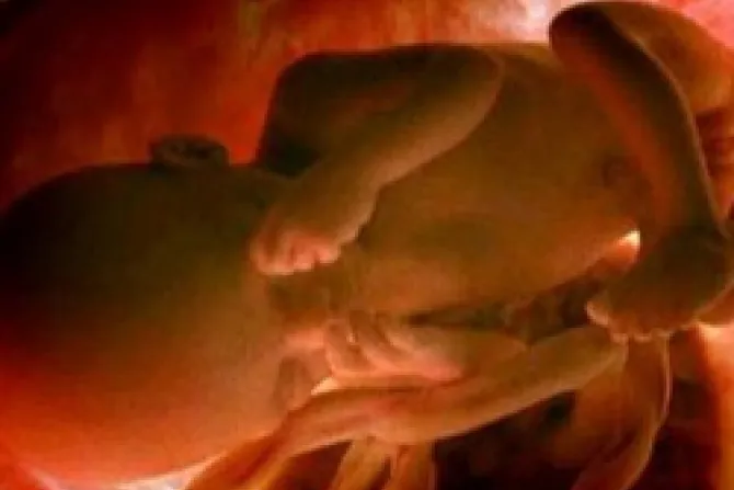 Debate científico ante el aborto: ¿A partir de cuándo un no nacido siente dolor?