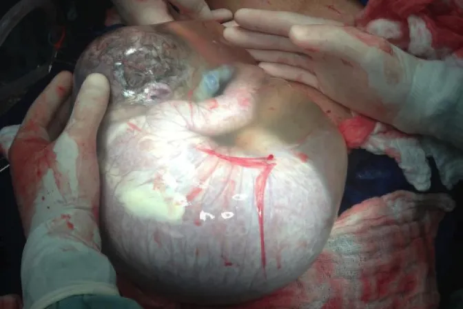 [FOTO] ¿La ley debe permitir el aborto de este bebé?