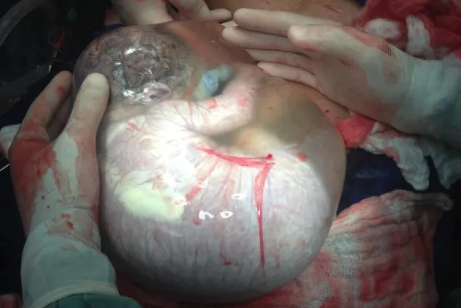 [FOTO] ¿La ley debe permitir el aborto de este bebé?