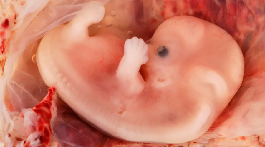 Embrion Humano de 9 Semanas de Gestación: Wikipedia Ed Uthman (CC-BY-2.0)